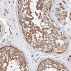 Anti-NDOR1 Antibody