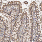 Anti-NDOR1 Antibody