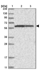 Anti-NDOR1 Antibody