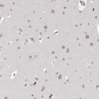 Anti-ZNF770 Antibody