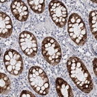 Anti-PWP2 Antibody