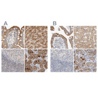 Anti-HDHD3 Antibody