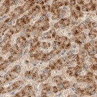 Anti-HDHD3 Antibody