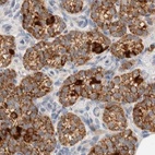 Anti-HDHD3 Antibody