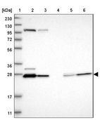 Anti-HDHD3 Antibody