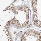 Anti-ZNF341 Antibody