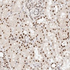 Anti-ZNF768 Antibody