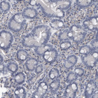 Anti-ARHGEF10 Antibody