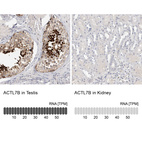 Anti-ACTL7B Antibody