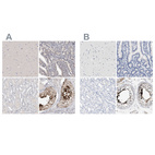 Anti-ACTL7B Antibody