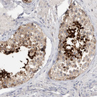 Anti-ACTL7B Antibody