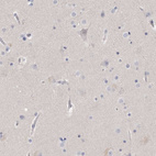 Anti-ACTL7B Antibody