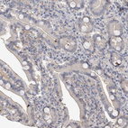 Anti-ACTL7B Antibody