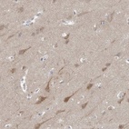 Anti-GPHN Antibody