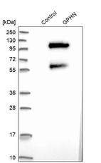 Anti-GPHN Antibody