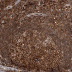 Anti-GFRA2 Antibody