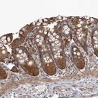 Anti-SNX16 Antibody