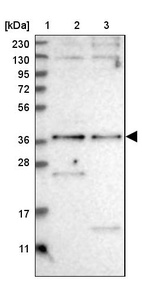 Anti-SNX16 Antibody