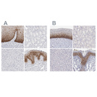 Anti-LY6D Antibody