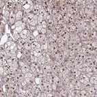 Anti-MAF1 Antibody