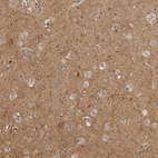 Anti-CUEDC1 Antibody