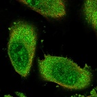 Anti-ZNF114 Antibody