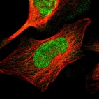 Anti-TMEM65 Antibody