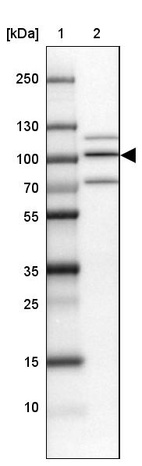 Anti-TGS1 Antibody