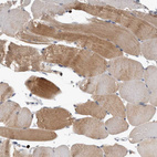 Anti-PEBP4 Antibody