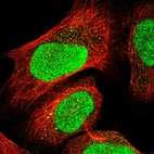 Anti-GTF2E2 Antibody