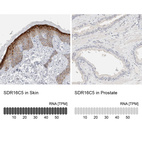 Anti-SDR16C5 Antibody