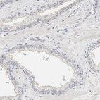 Anti-SDR16C5 Antibody