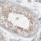 Anti-CEP295NL Antibody