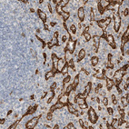 Anti-RAB32 Antibody