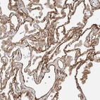 Anti-RAB32 Antibody