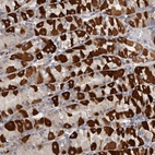 Anti-EDEM3 Antibody