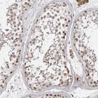 Anti-PHF3 Antibody