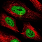 Anti-PHF3 Antibody