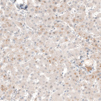 Anti-NMU Antibody