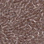 Anti-RSU1 Antibody