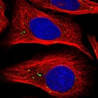 Anti-RSU1 Antibody