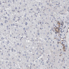 Anti-PLEC Antibody