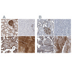 Anti-PLEC Antibody