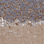 Anti-ARMC1 Antibody