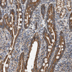 Anti-ARMC1 Antibody