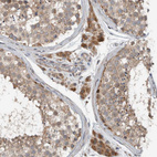 Anti-ARMC1 Antibody