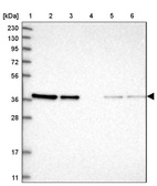 Anti-ARMC1 Antibody