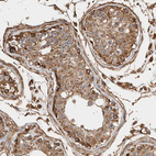 Anti-ZNF397 Antibody