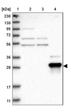 Anti-ZNF397 Antibody