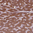 Anti-SLC27A2 Antibody